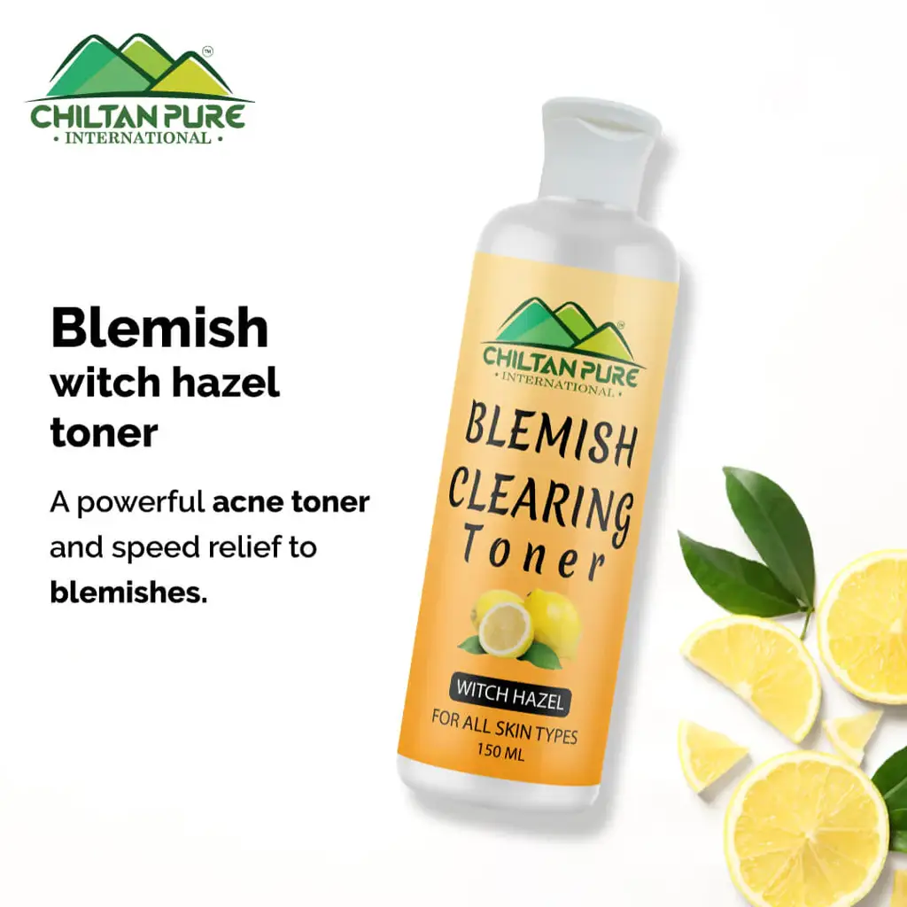 blemish-clearing-toner-soothes-redness-inflammation-fights-with-acne-helps-prevent-breakouts-good-for-all-skin-types-150ml-417001
