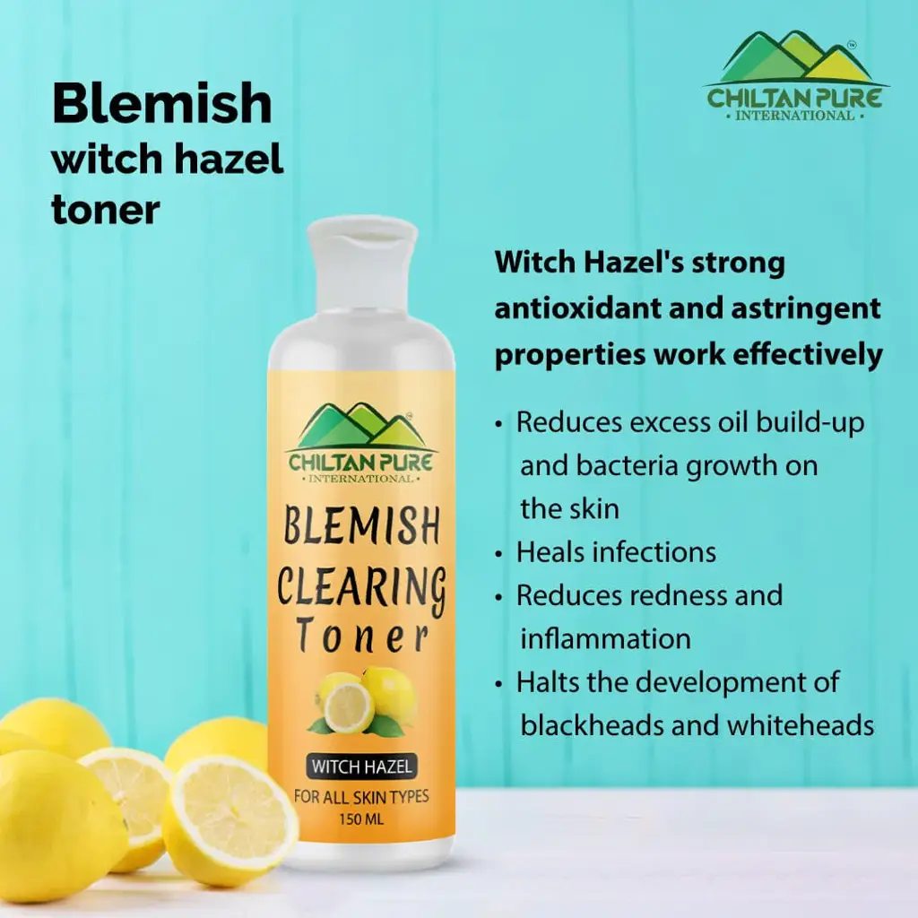 blemish-clearing-toner-soothes-redness-inflammation-fights-with-acne-helps-prevent-breakouts-good-for-all-skin-types-150ml-826925