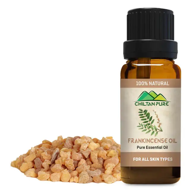 frankincense-essential-oil-best-for-removing-dark-circles-20ml-752539