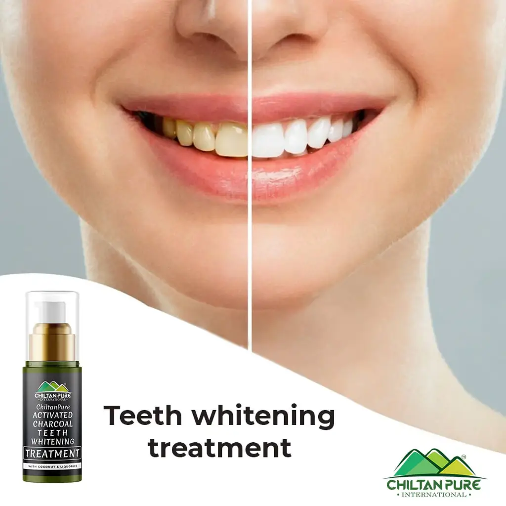 activated-charcoal-teeth-whitening-treatment-whitens-teeth-naturally-kills-cavity-causing-bacteria-amp-eliminates-bad-breath-548288