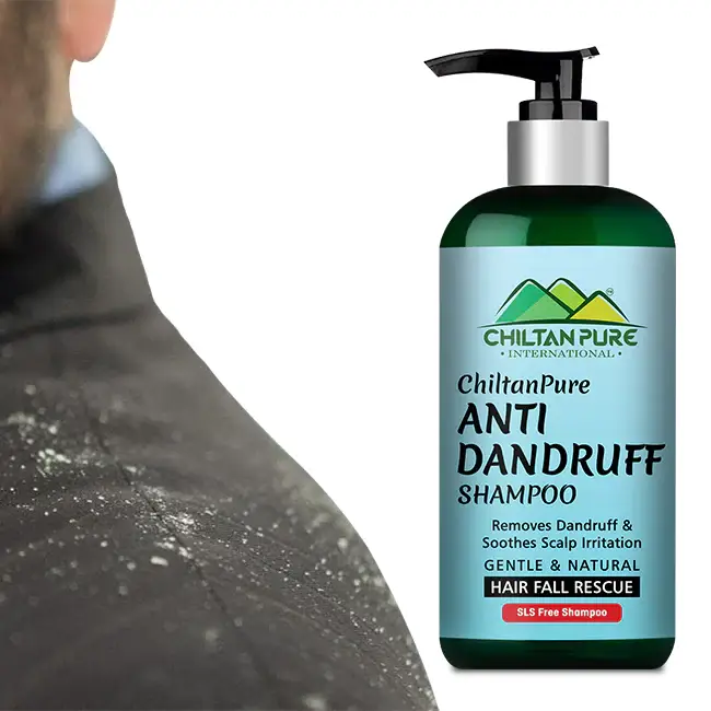 AntiDandruffShampoo