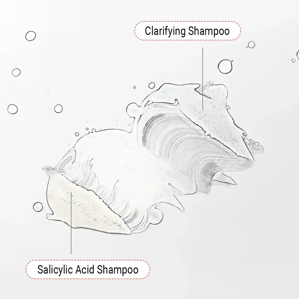 Anti-Dandruff-Shampoo-Bundle-AccuFix-Cosmetics-103954253