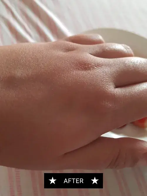 Concentrated Skin Repair Balm4