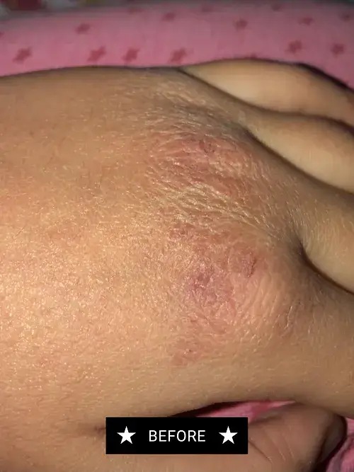 Concentrated Skin Repair Balm3